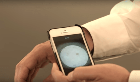 Skin Analytics’ device in action. Photo Credit: Skin Analytics / YouTube